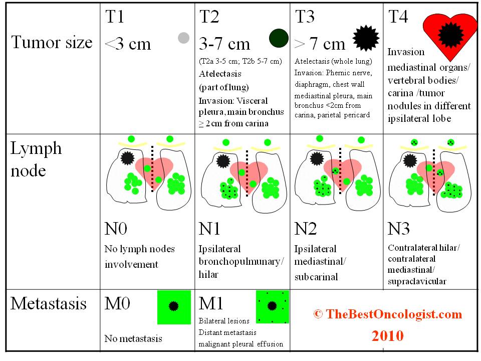 Lung cancer staging